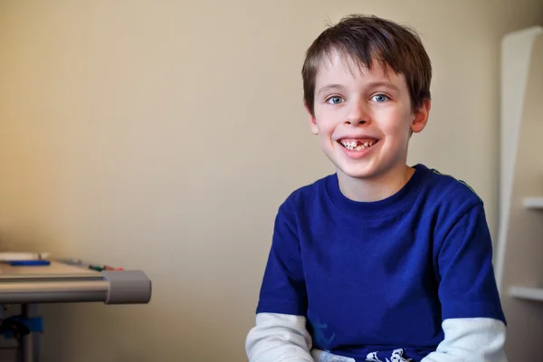 Retrato do menino que perdeu o dente de leite — Fotografia de Stock