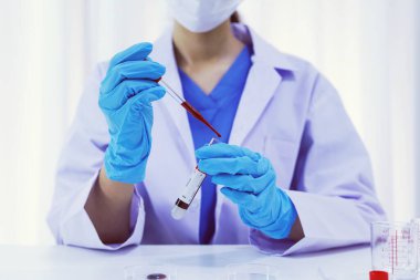 Coronavirus covid-19 'u tutan bilim adamı enfekte olmuş kan örneği tüpü. Kan örneği toplama tüpleri ve şırınga Coronavirus Covid-19 aşı araştırmalarıyla laboratuvardaki kanın DNA testi.