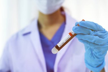 Coronavirus covid-19 'u tutan bilim adamı enfekte olmuş kan örneği tüpü. Kan örneği toplama tüpleri ve şırınga Coronavirus Covid-19 aşı araştırmalarıyla laboratuvardaki kanın DNA testi.