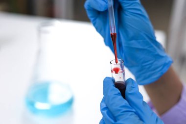 Coronavirus covid-19 'u tutan bilim adamı enfekte olmuş kan örneği tüpü. Kan örneği toplama tüpleri ve şırınga Coronavirus Covid-19 aşı araştırmalarıyla laboratuvardaki kanın DNA testi.