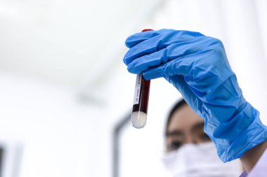 Coronavirus covid-19 'u tutan bilim adamı enfekte olmuş kan örneği tüpü. Kan örneği toplama tüpleri ve şırınga Coronavirus Covid-19 aşı araştırmalarıyla laboratuvardaki kanın DNA testi.
