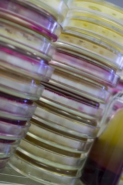 Petri yemekler bakteri tarımı için