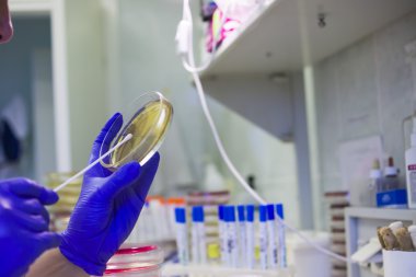 Petri yemekler laboratuvar ile çalışan bilim adamı