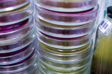 Petri yemekler bakteri tarımı için