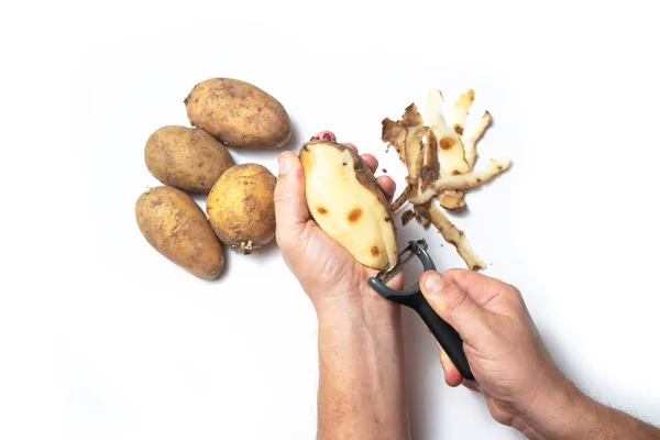 Guy Peels Potatoes White Background Hands Rotten Potato — Stock Photo, Image