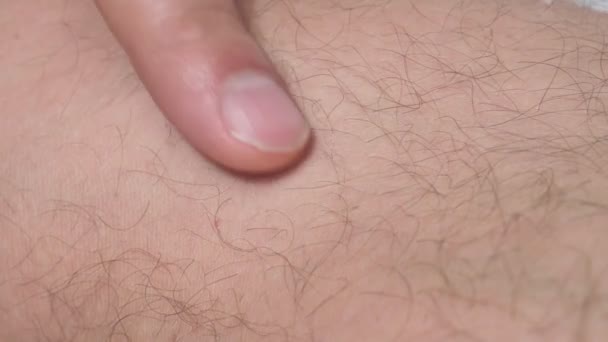 Крупним планом чоловіче волосся людської шкіри макрос. Волохатий фон . — стокове відео