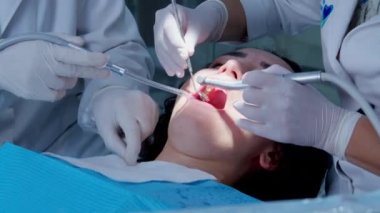 Bir dişçi genç kadın hastasına sözlü muayene yapıyor. Ortodontiste bir randevu. Geçici bir dolguyu kalıcı bir dolguyla değiştirmek. Parlatma.