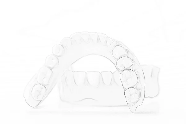 Denture médicale sourire mâchoires dents — Photo