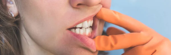 Vrouw Handschoenen Toont Haar Scheef Tanden — Stockfoto