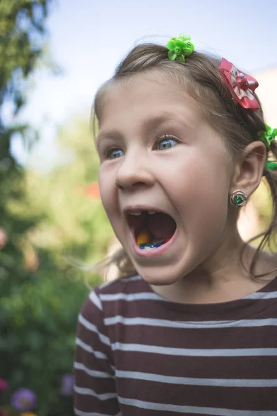 Kind Met Een Gebit Orthodontisch Apparaat Zonder Een Tand — Stockfoto