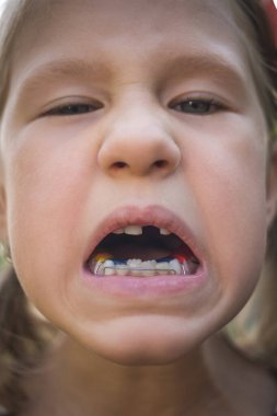 Diş hekimi olan ve tek dişi olmayan bir çocuk..