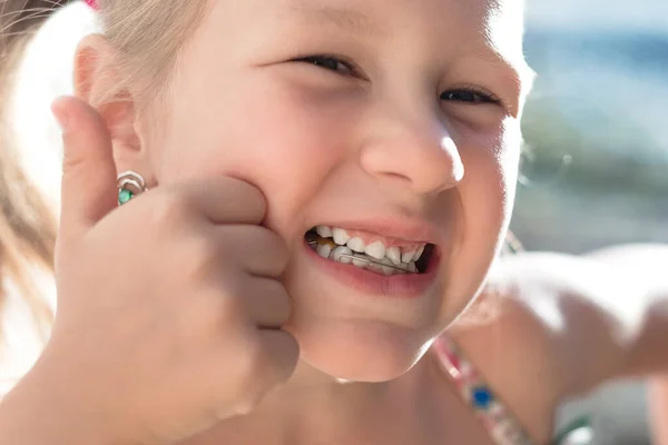 Portret Dziewczynki Chwiejnym Dziecięcym Zębem Kciukiem Górze — Zdjęcie stockowe