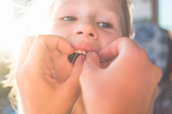 Het Verwijderen Van Een Baby Tand Met Behulp Van Een — Stockfoto