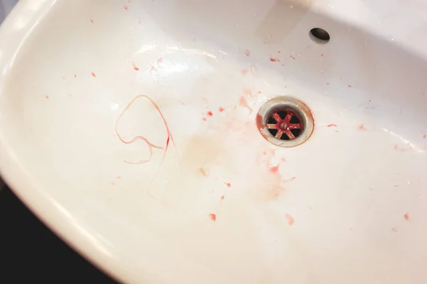 Lavabo Blanco Residuos Hilo Dental Manchas Sangre Causadas Por Daño — Foto de Stock