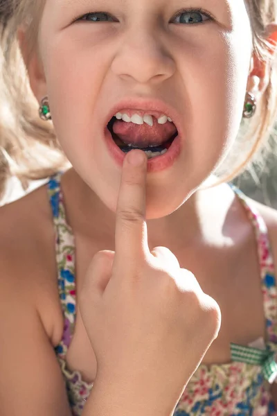 Menina Aponta Dedo Para Dente Leite Oscilante — Fotografia de Stock