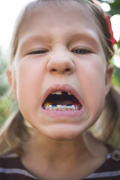 Dziecko Ortodontą Dentystyczną Bez Jednego Zęba — Zdjęcie stockowe