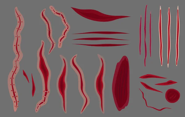 벡터 삽화 세트의 꿰매기, 회색 배경에 흉터. 멍울 과 도살장을 평평 한 형태로 수집하는 모습. — 스톡 벡터