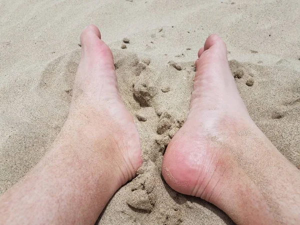 Mannelijke voeten en tenen in het zand op het strand — Stockfoto