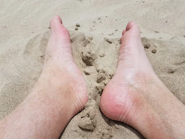 Pies y dedos de los pies masculinos en arena en la playa — Foto de Stock