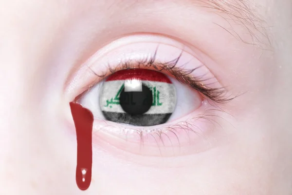 human's eye with national flag of iraq with bloody tears