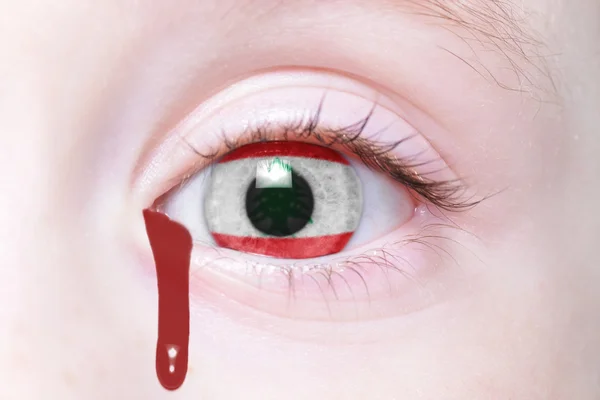 Ojo humano con bandera nacional de lebanón con lágrimas sangrientas — Foto de Stock