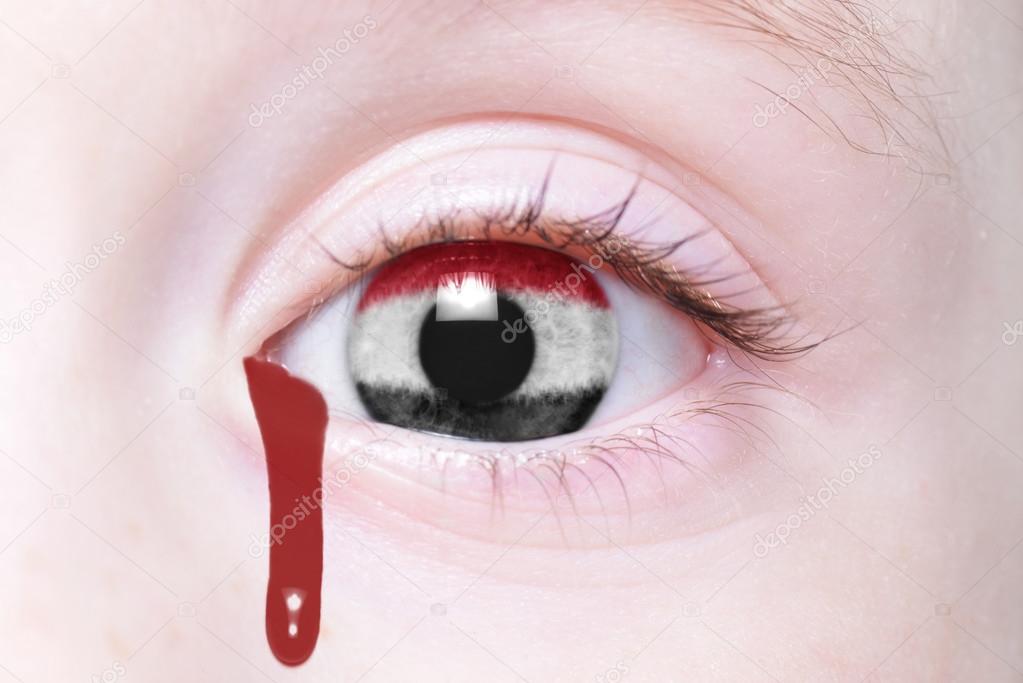 human's eye with national flag of yemen with bloody tears