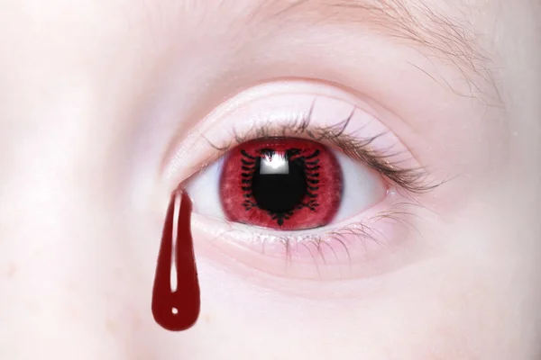 Ojo humano con bandera nacional de albania con lágrimas sangrientas . — Foto de Stock
