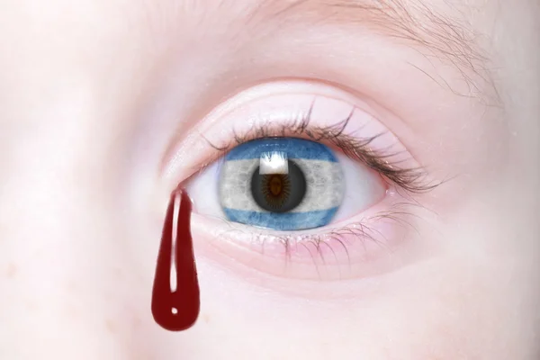 Oeil humain avec drapeau national de l'argentine avec des larmes sanglantes . — Photo
