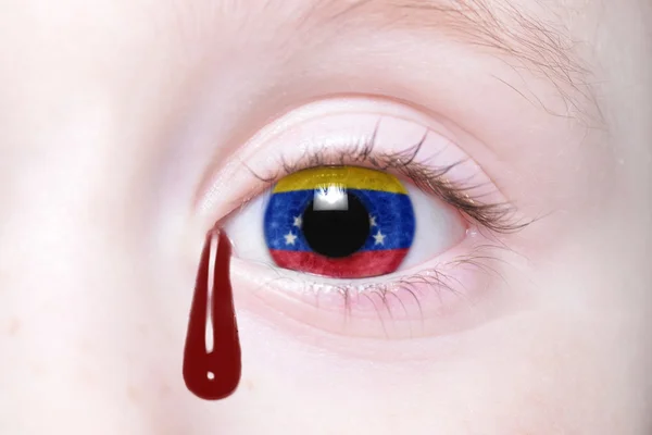 Olho humano com bandeira nacional da Venezuela com lágrimas sangrentas . — Fotografia de Stock