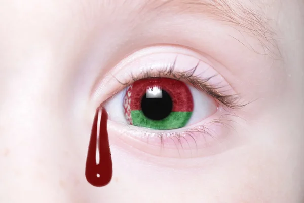 Ojo humano con bandera nacional de belarus con lágrimas sangrientas . — Foto de Stock