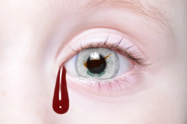 Oeil humain avec drapeau national de cyprus avec des larmes sanglantes . — Photo
