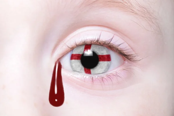Ojo humano con bandera nacional de Inglaterra con lágrimas sangrientas . — Foto de Stock
