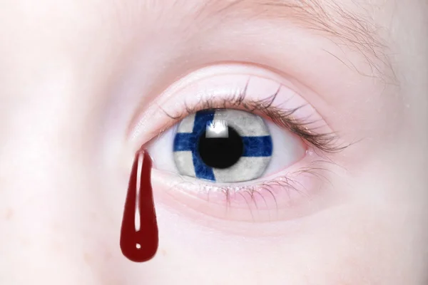 Ojo humano con bandera nacional de Finlandia con lágrimas sangrientas . — Foto de Stock