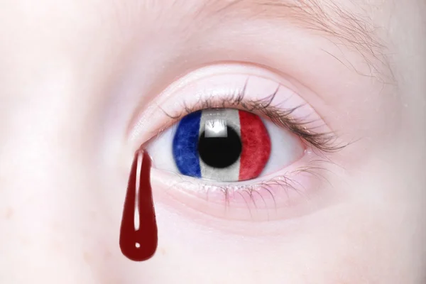 Ojo humano con bandera nacional de Francia con lágrimas sangrientas . — Foto de Stock