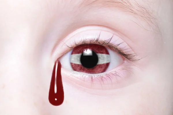 Ojo humano con bandera nacional de latvia con lágrimas sangrientas . — Foto de Stock