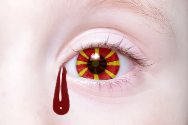 Menselijk oog met nationale vlag van Macedonië met bloedige tranen. — Stockfoto