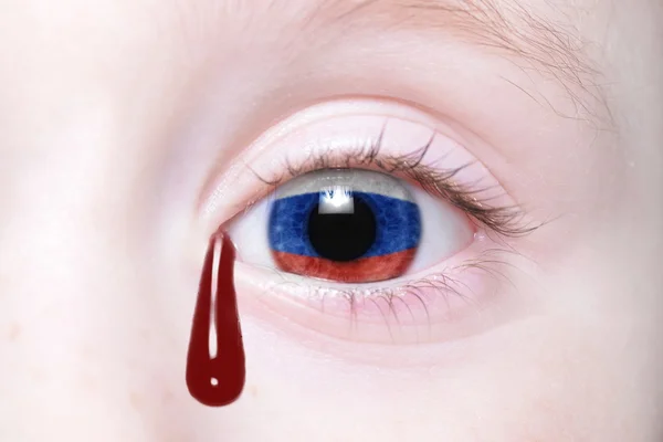 Ojo humano con bandera nacional de Rusia con lágrimas sangrientas . — Foto de Stock