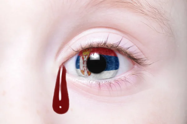 Menschenauge mit Nationalflagge Serbiens mit blutigen Tränen. — Stockfoto