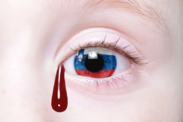 Ojo humano con bandera nacional de slovenia con lágrimas sangrientas . — Foto de Stock