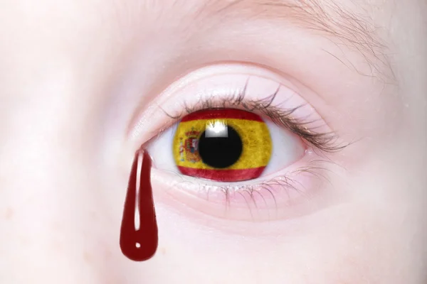 Oeil humain avec drapeau national de l'Espagne avec des larmes sanglantes . — Photo