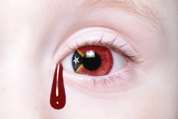 Ojo humano con bandera nacional de Timor Oriental — Foto de Stock