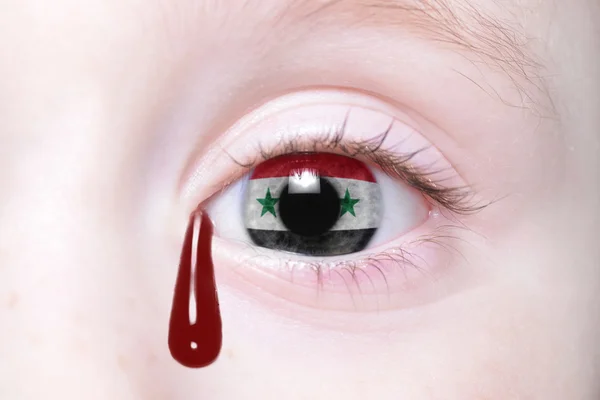 Ojo humano con bandera nacional de Siria — Foto de Stock
