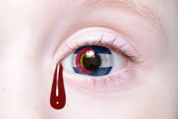 Ojo humano con bandera del estado de Colorado con lágrimas sangrientas — Foto de Stock