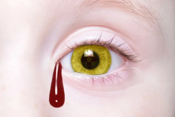 Human 's eye with new mexico state flag with bloody tears — стоковое фото