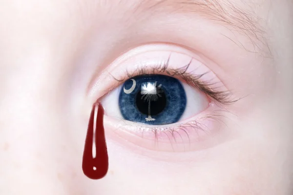 Ojo humano con la bandera del estado de Carolina del Sur con lágrimas sangrientas — Foto de Stock