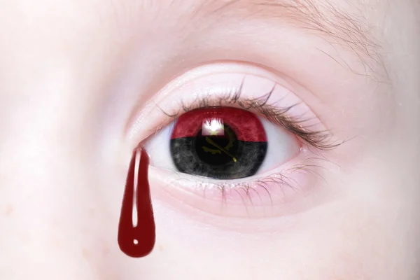 Human 's eye with national flag of angola with bloody tears — стоковое фото