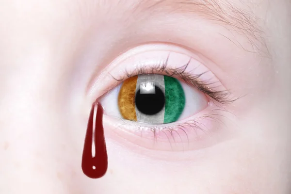 Ojo humano con bandera nacional de Costa de Marfil con lágrimas sangrientas — Foto de Stock