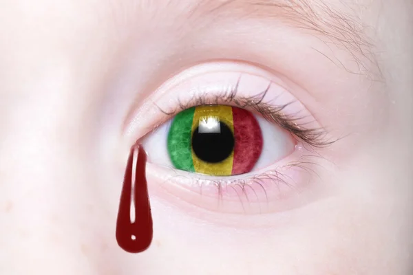 Human 's eye with national flag of mali with bloody tears — стоковое фото