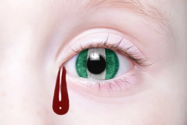 Oeil de l'homme avec drapeau national de nigeria avec des larmes sanglantes — Photo