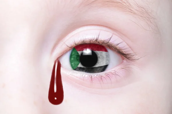 Ojo humano con bandera nacional de sudan con lágrimas sangrientas — Foto de Stock